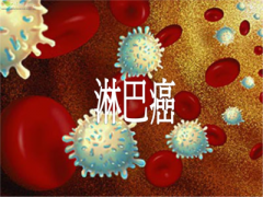 日常这些行为：染发、肥胖会增加淋巴瘤的发病风险