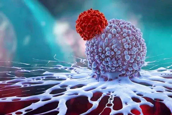 治疗肿瘤什么方法好？发达国家都在用智慧精准放疗：少遭罪、疗效好！