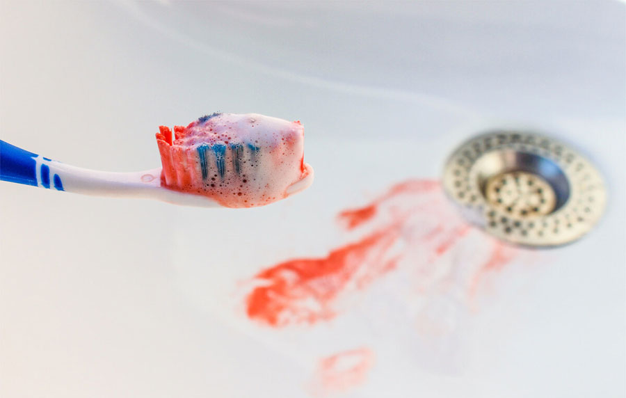 肝癌早期症状有哪些？肿瘤专家提醒：这7个症状要警惕，及时发现及时控制病情