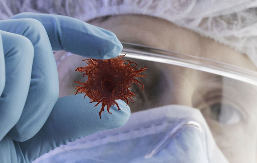 肺癌会出现哪些症状？肺癌的6大常见症状，国际肿瘤中心专家胡群峰教授一一为你解惑